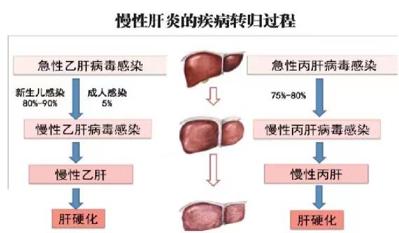 【健康科普】世界肝炎日——堅持早預防，加強檢測發現，規范抗病毒治療